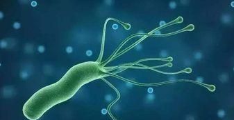 孩子容易感染幽门螺杆菌吗?消化科医生：感染有3个表现休闲区蓝鸢梦想 - Www.slyday.coM