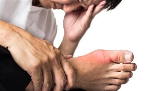 为何有人尿酸500频发痛风,有人却不疼不痒?看完涨知识了