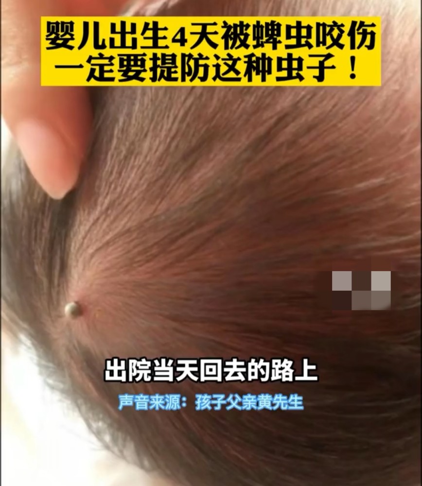 夏季做好4件事,避免这种吸血虫叮咬