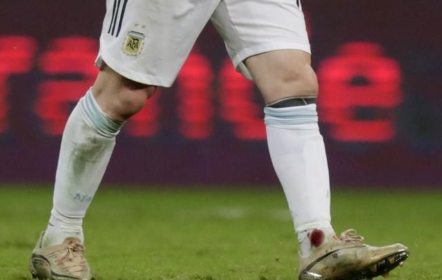 丧失底线!阿根廷遭遇点球误判,梅西脚踝被踢出血,裁判视而不见