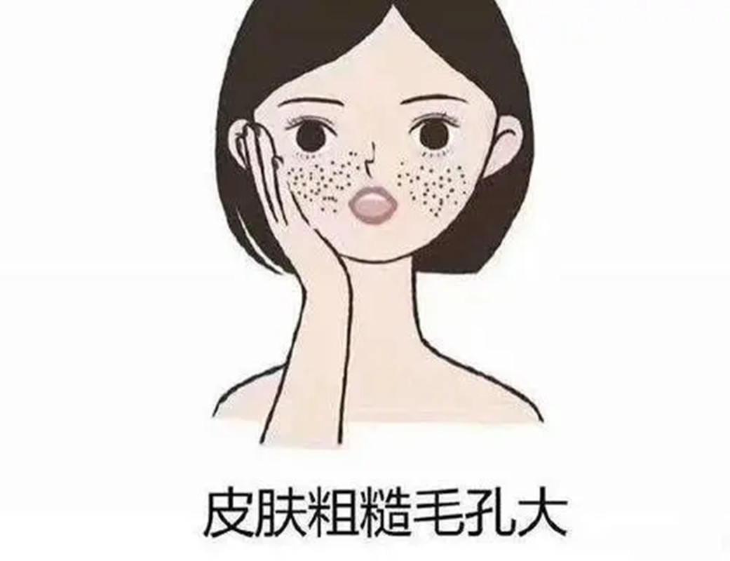 毛孔粗大别不当回事,这几个问题需要注意,避免形成"马蜂窝"