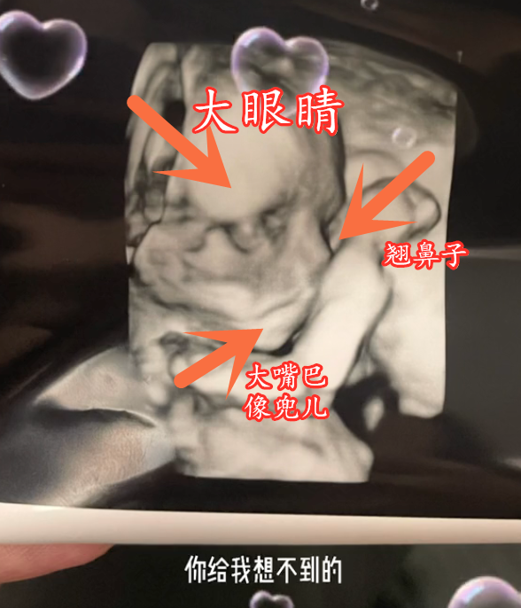 小猪先生兜儿晒孩子四维图大眼睛高鼻梁大嘴巴比小猪妹强多了