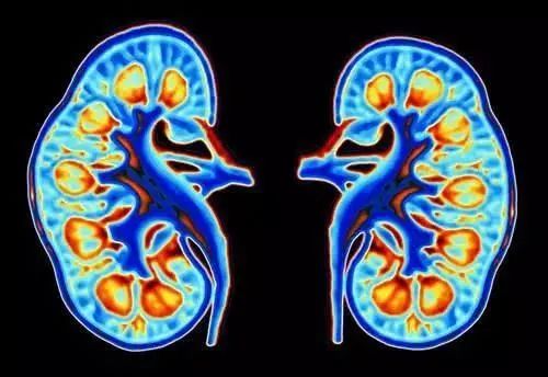 29岁小伙不痛不痒，查出尿毒症，排尿有5个变化，不能再拖休闲区蓝鸢梦想 - Www.slyday.coM