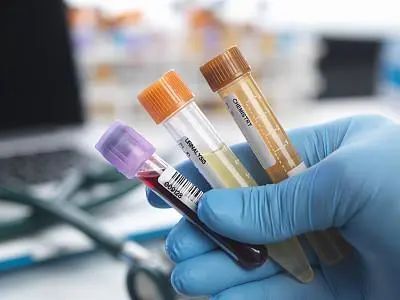 29岁小伙不痛不痒，查出尿毒症，排尿有5个变化，不能再拖休闲区蓝鸢梦想 - Www.slyday.coM