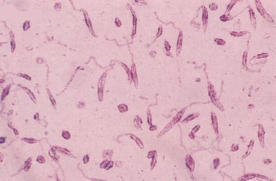 在感染利什曼原虫的人群中,每年有7万人不幸逝世,而很多人也因为