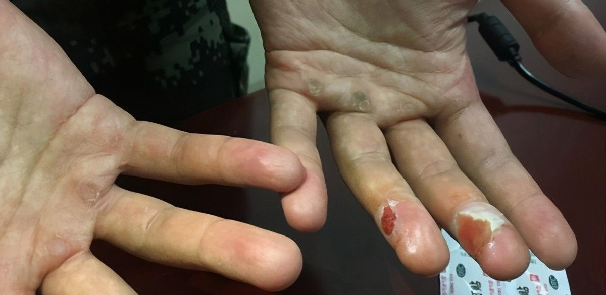 云南男孩高考713分被清华录取,却失声痛哭,看到手后众人泪奔休闲区蓝鸢梦想 - Www.slyday.coM