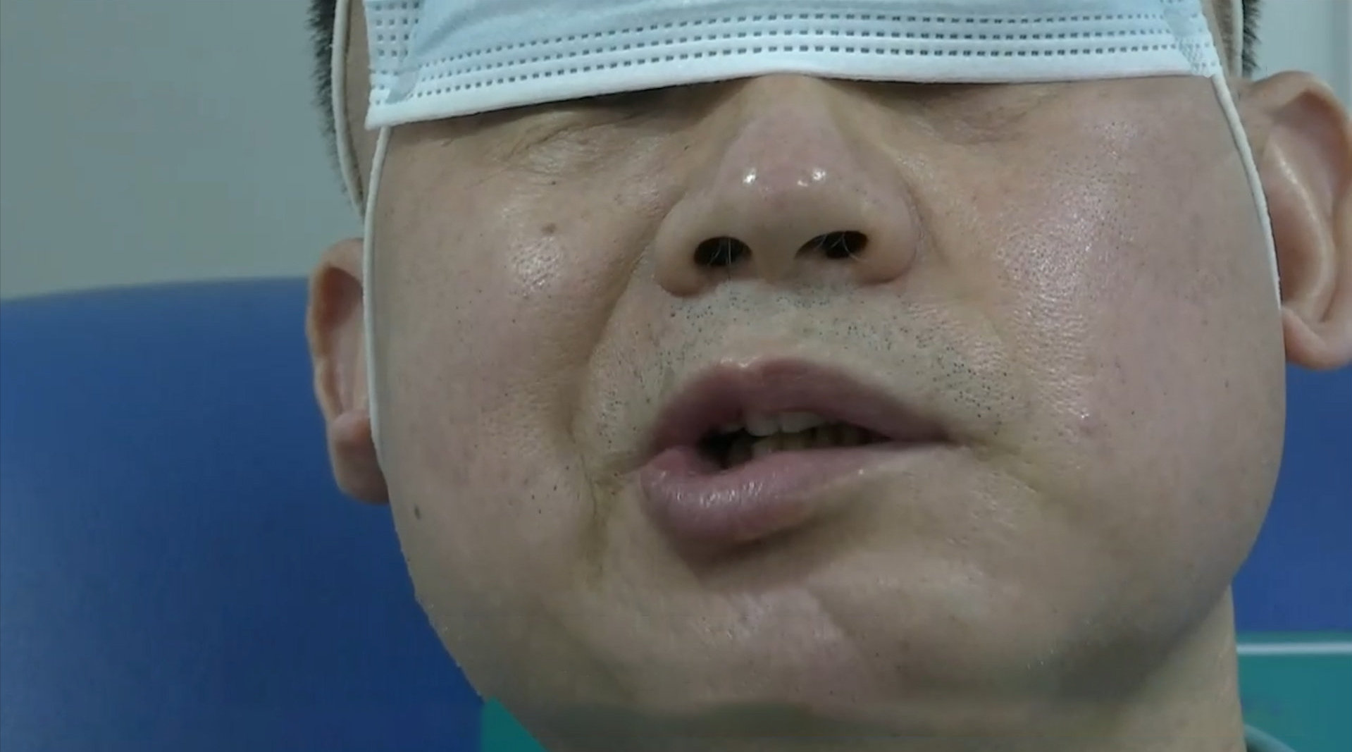 男子长时间吹空调得面瘫 千万别贪凉!