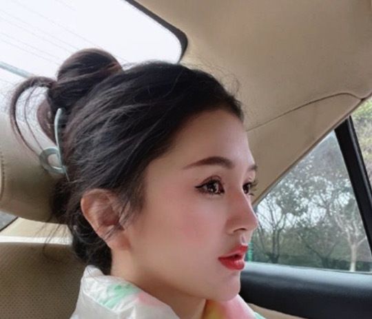 网红小冉因抽脂感染去世,女孩们的容貌焦虑如何破?休闲区蓝鸢梦想 - Www.slyday.coM