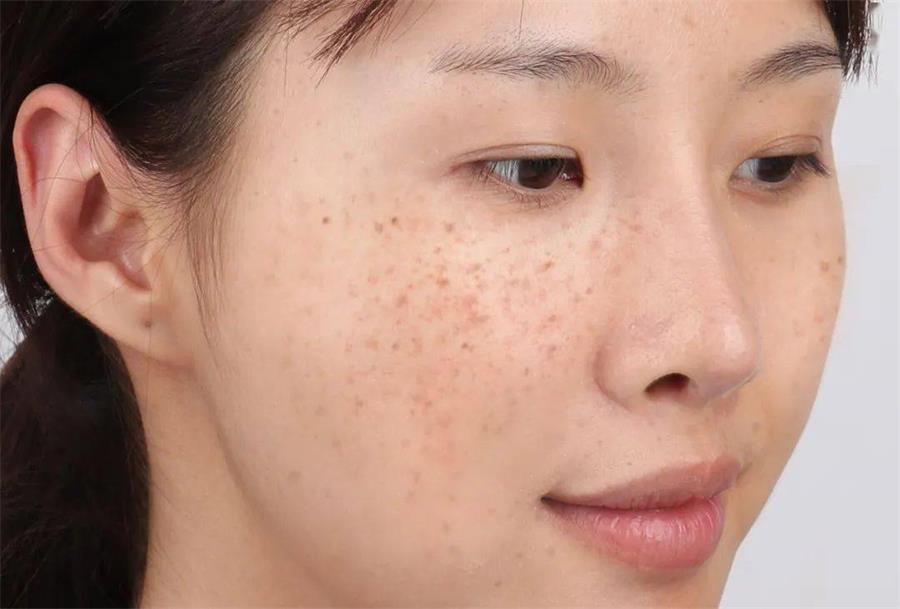 每天清晨和睡前,都要做面部清洁,确保脸部没有灰尘污垢,不会堵塞毛孔.