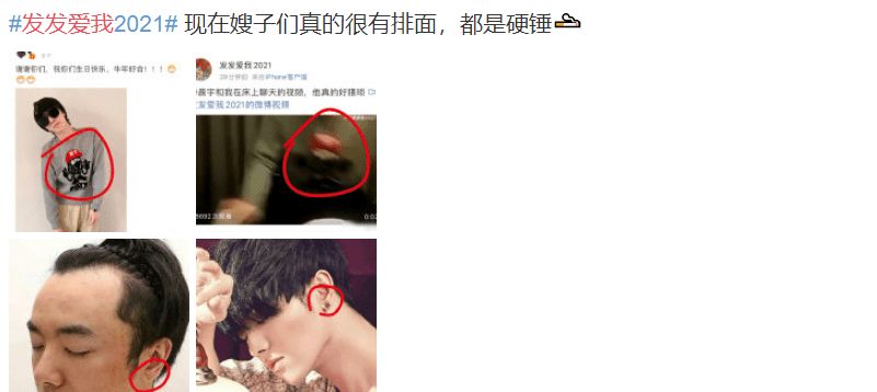 爆料华晨宇整容当事人道歉,自称图源朋友,恳请花花放过休闲区蓝鸢梦想 - Www.slyday.coM 爆料华晨宇整容当事人道歉,自称图源朋友,恳请花花放过休闲区蓝鸢梦想 - Www.slyday.coM