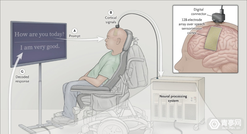目前,市面上已经有各种不同形式的侵入式和非侵入式脑机接口技术,其中