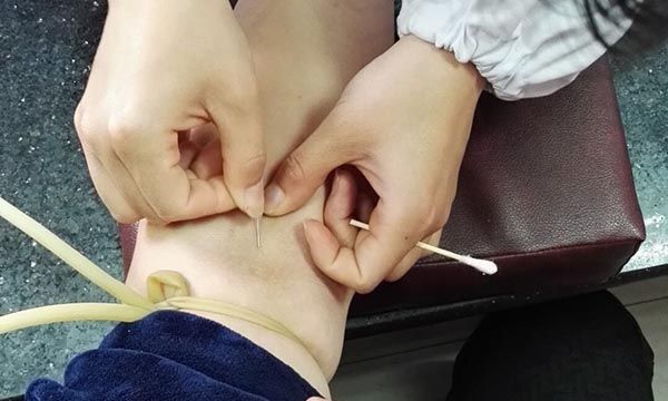 抽血、输液后,扎针处为何会出现一片淤青?不妨了解下,涨涨知识休闲区蓝鸢梦想 - Www.slyday.coM 抽血、输液后,扎针处为何会出现一片淤青?不妨了解下,涨涨知识休闲区蓝鸢梦想 - Www.slyday.coM