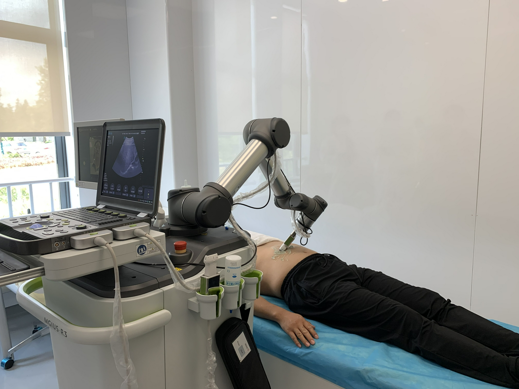 来自复旦大学附属中山医院的超声科医生可以远程为患者做腹部b超