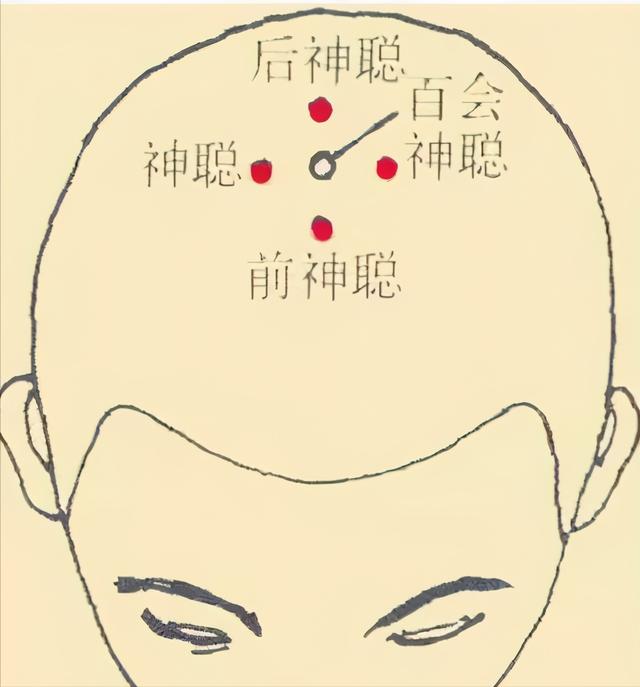 一,颈部失眠穴加头顶四神聪常用的穴位推拿头面部总领一身之气.