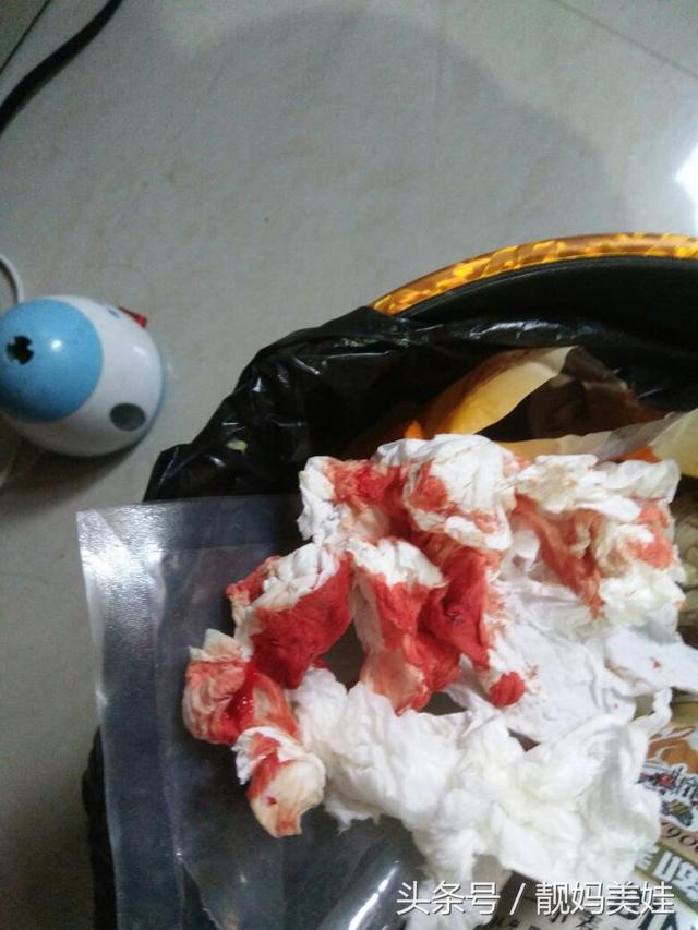 2岁儿子流鼻血昏过去,医生检查后宣告已死亡,只怪妈妈这个动作