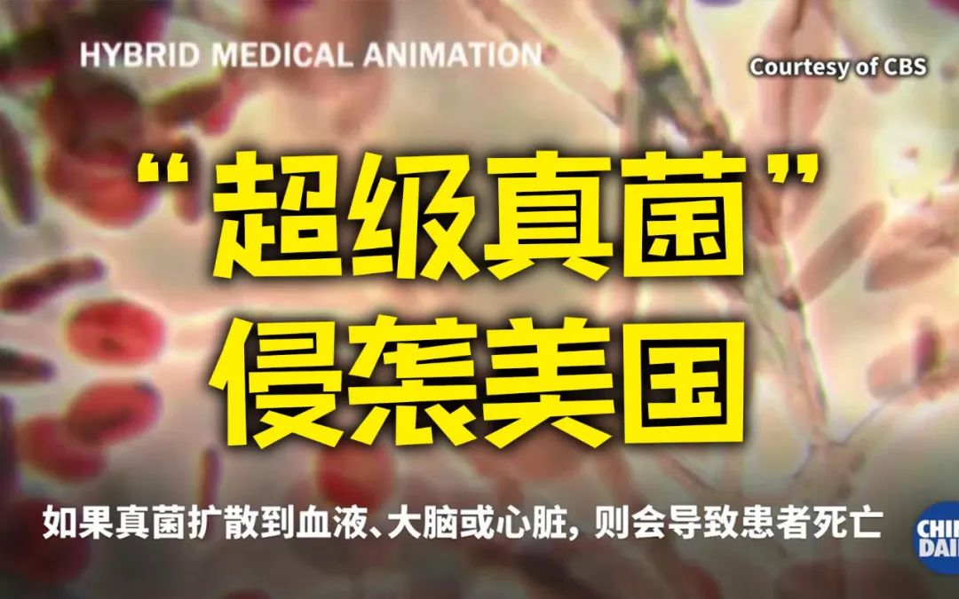 “超级真菌”爆发！发生人际传播，已致4人死亡休闲区蓝鸢梦想 - Www.slyday.coM