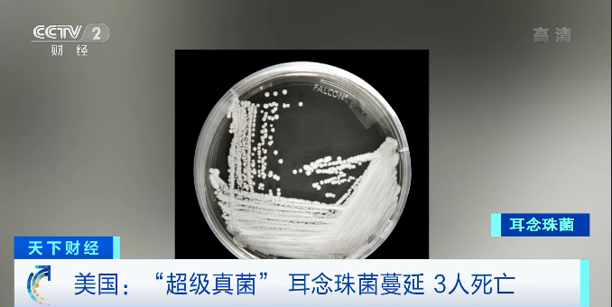“超级真菌”蔓延！已致3人死亡！有证据表明“无法治疗”休闲区蓝鸢梦想 - Www.slyday.coM