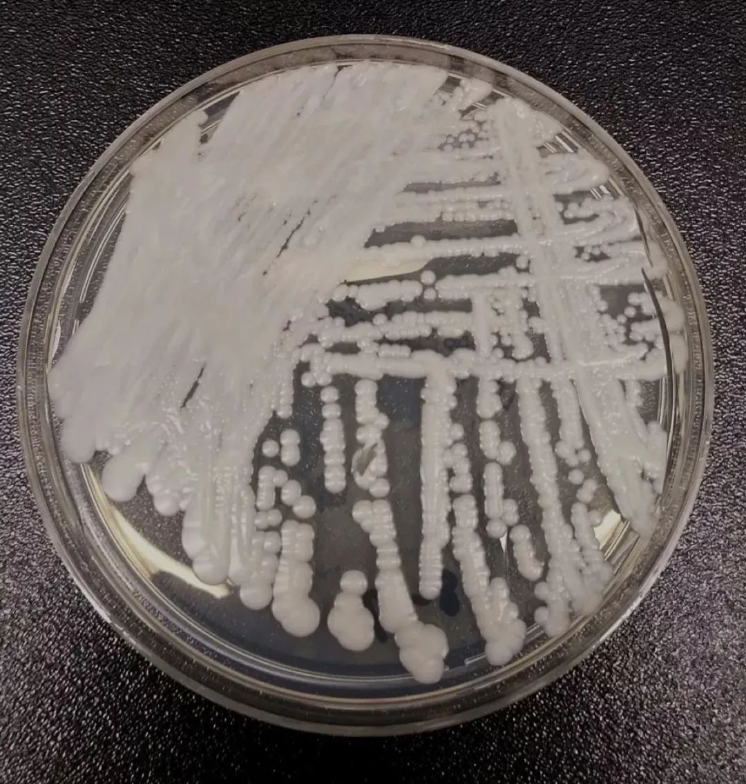 “超级真菌”爆发！发生人际传播，已致4人死亡休闲区蓝鸢梦想 - Www.slyday.coM