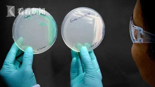 能人传人且致命！美国出现“超级真菌”群体感染 已致4人死亡休闲区蓝鸢梦想 - Www.slyday.coM