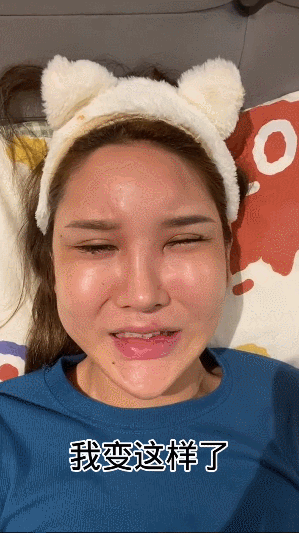 女网红出现整容后遗症脸肿成馒头眼睛睁不开崩溃痛哭将要住院
