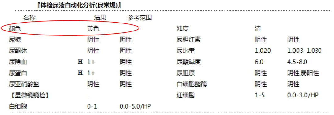 尿常规检查 就能看出来肾好不好 一文教你看懂 血糖 肾脏 新浪新闻