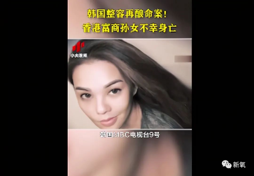去年,香港富豪"堡狮龙"创始人罗定邦孙女罗贝儿,在韩国进行抽脂手术时