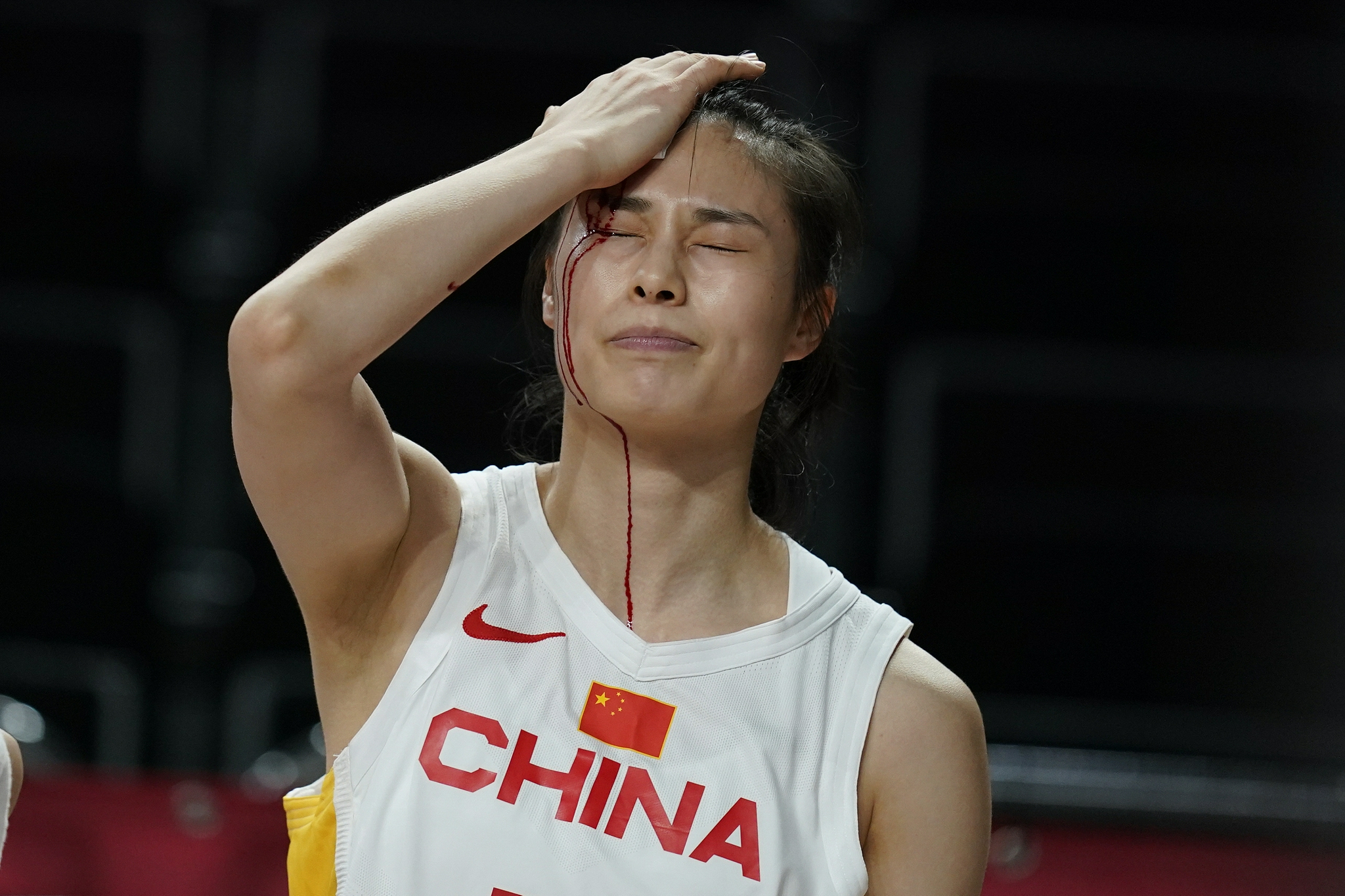 王思雨在拼抢时额头磕破,图|视觉中国