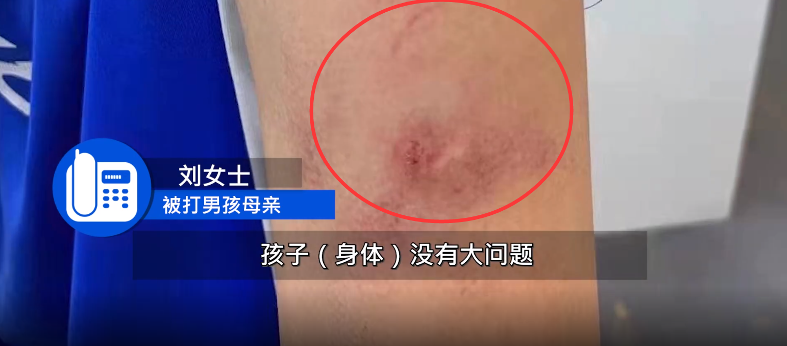 12岁男孩遭大一学生殴打？与兼职助教发生口角？警方：正依法处理休闲区蓝鸢梦想 - Www.slyday.coM