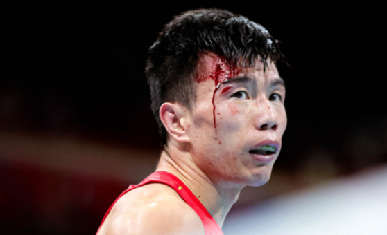 被日本对手肘击撞头,中国名将头破血流被判负,发声炮轰东道主