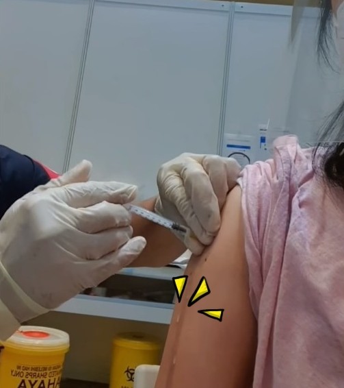 女人打疫苗图片图片