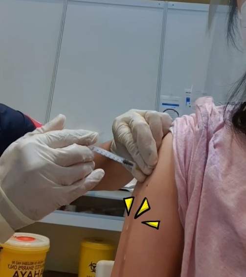 女子打疫苗半剂流到手臂上医护辩称总比打空针好