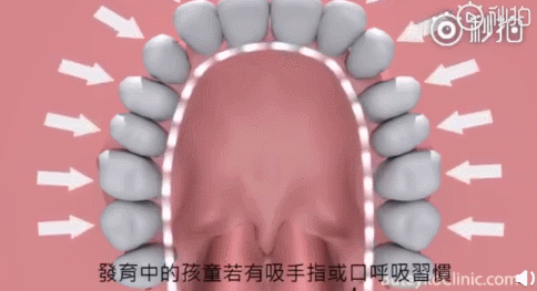 担心变丑,用网红"封嘴贴"给孩子封嘴?别再一错再错了