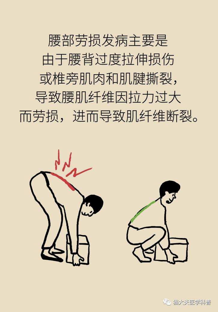 年纪轻轻也没干啥体力活儿怎么就腰肌劳损了