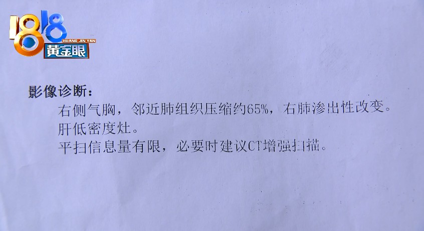 针灸后查出来气胸怀疑针灸扎到肺