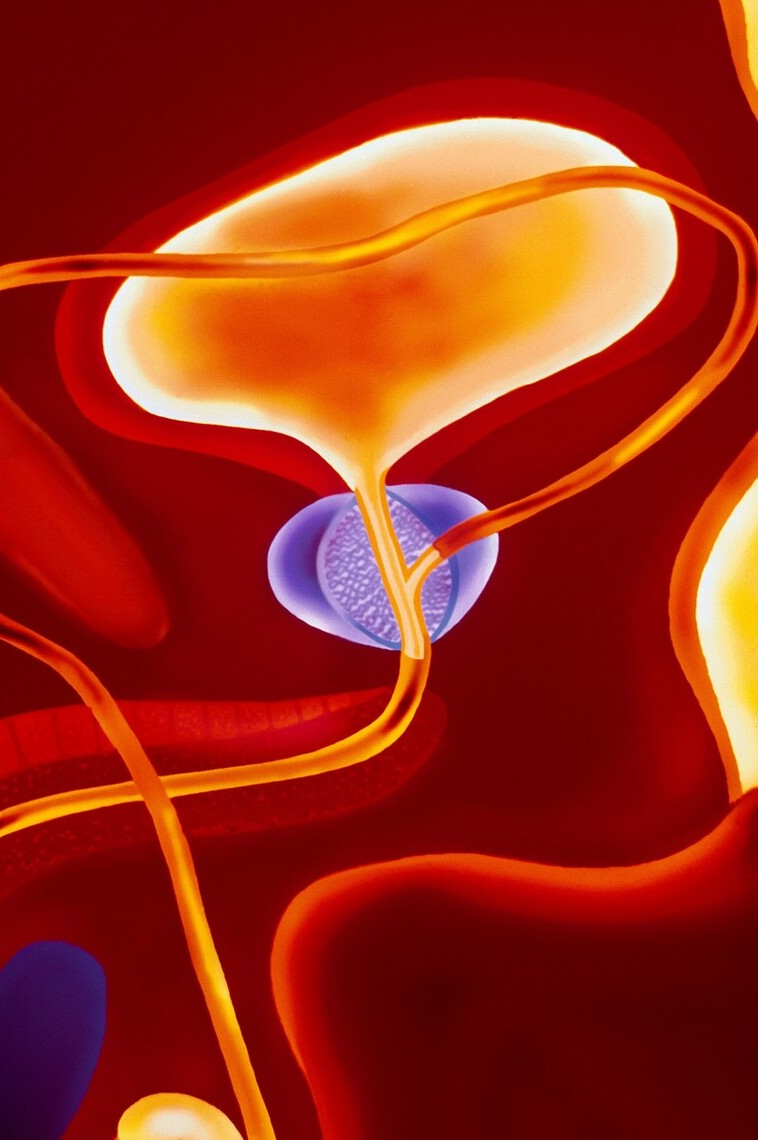 尿频总跑厕所是肾不好?辟谣:导致尿频的10种病因,一一说清休闲区蓝鸢梦想 - Www.slyday.coM 尿频总跑厕所是肾不好?辟谣:导致尿频的10种病因,一一说清休闲区蓝鸢梦想 - Www.slyday.coM