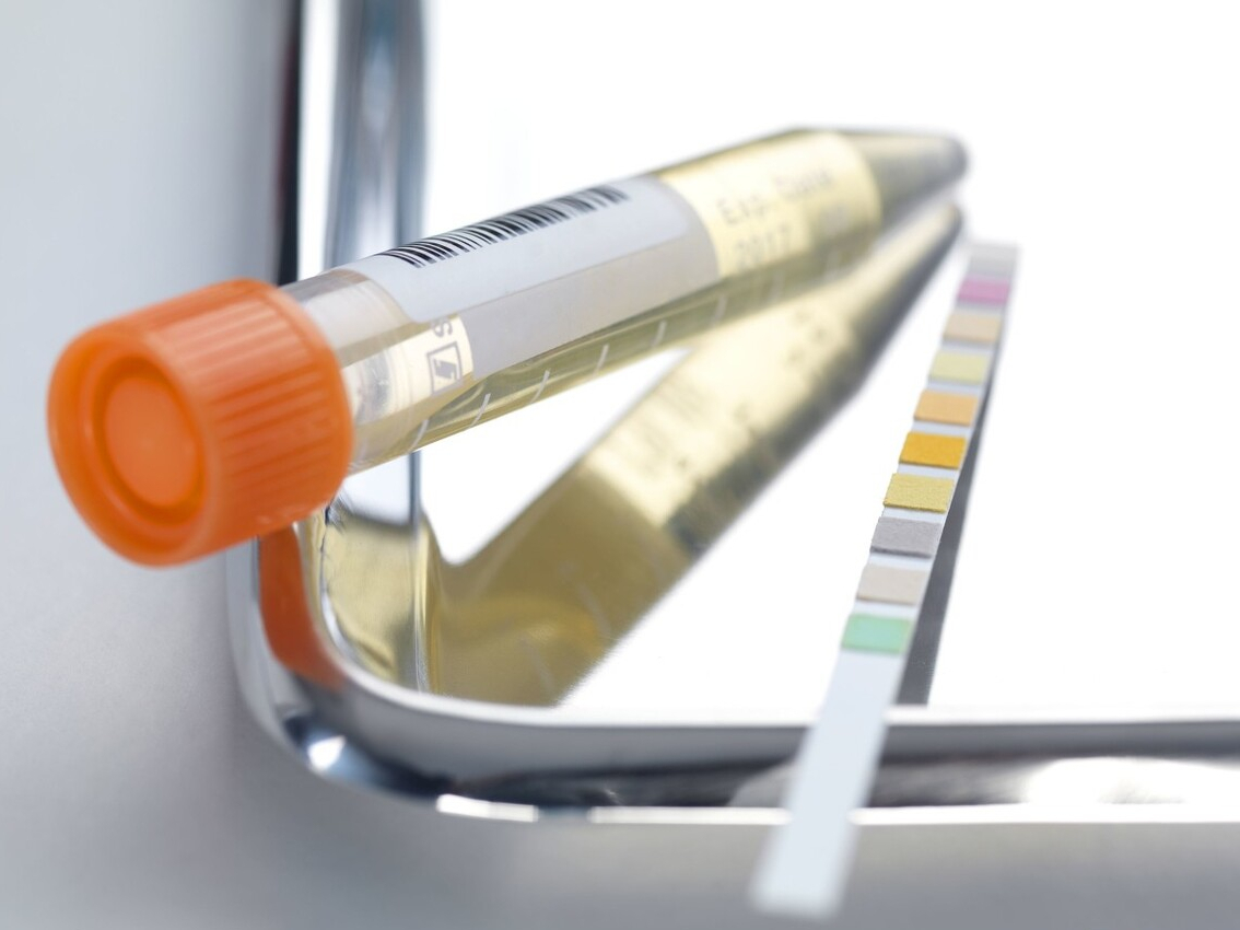 尿频总跑厕所是肾不好?辟谣:导致尿频的10种病因,一一说清休闲区蓝鸢梦想 - Www.slyday.coM 尿频总跑厕所是肾不好?辟谣:导致尿频的10种病因,一一说清休闲区蓝鸢梦想 - Www.slyday.coM