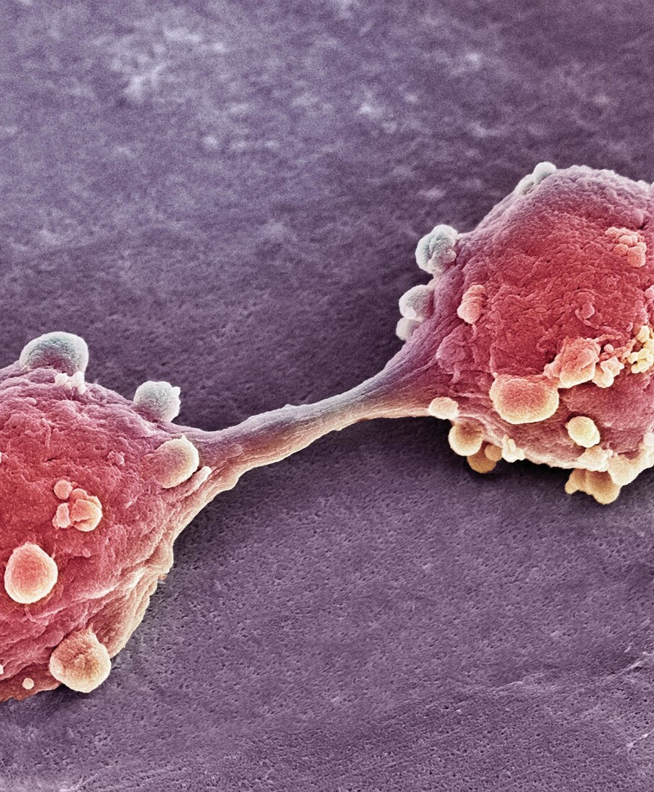 尿频总跑厕所是肾不好?辟谣:导致尿频的10种病因,一一说清休闲区蓝鸢梦想 - Www.slyday.coM 尿频总跑厕所是肾不好?辟谣:导致尿频的10种病因,一一说清休闲区蓝鸢梦想 - Www.slyday.coM