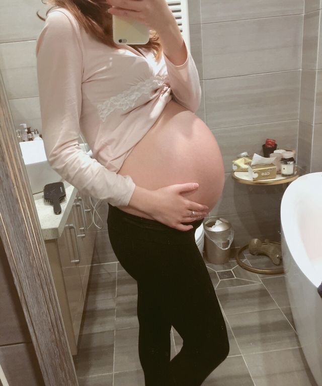 宝妈长纹十有八九!不想被妊娠纹"偏爱",专家教你妙招轻松制敌