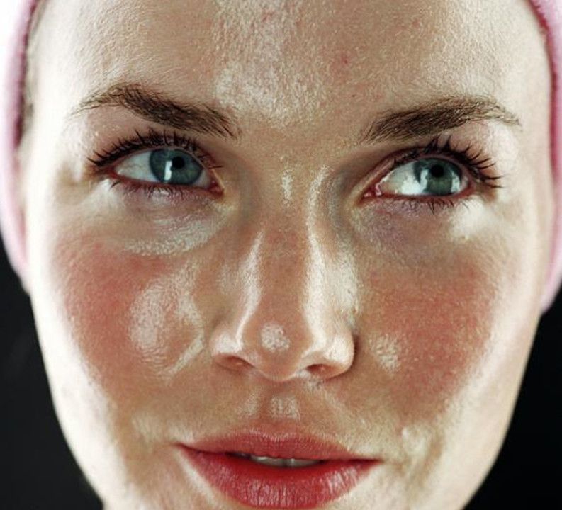 皮肤老爱出油这几个护肤知识要知道避免形成大油田