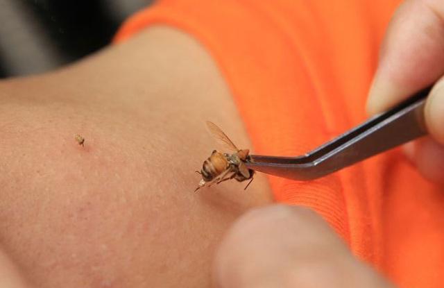 无论好坏,记得用这几种方式消肿止痛|蜜蜂|皮肤|毒针_新浪新闻