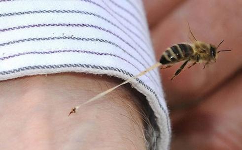 无论好坏,记得用这几种方式消肿止痛|蜜蜂|皮肤|毒针_新浪新闻