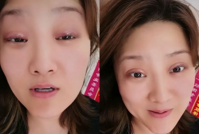 《乡村爱情》王云扮演者葛珊珊自爆整容,劝诫网友整容有风险