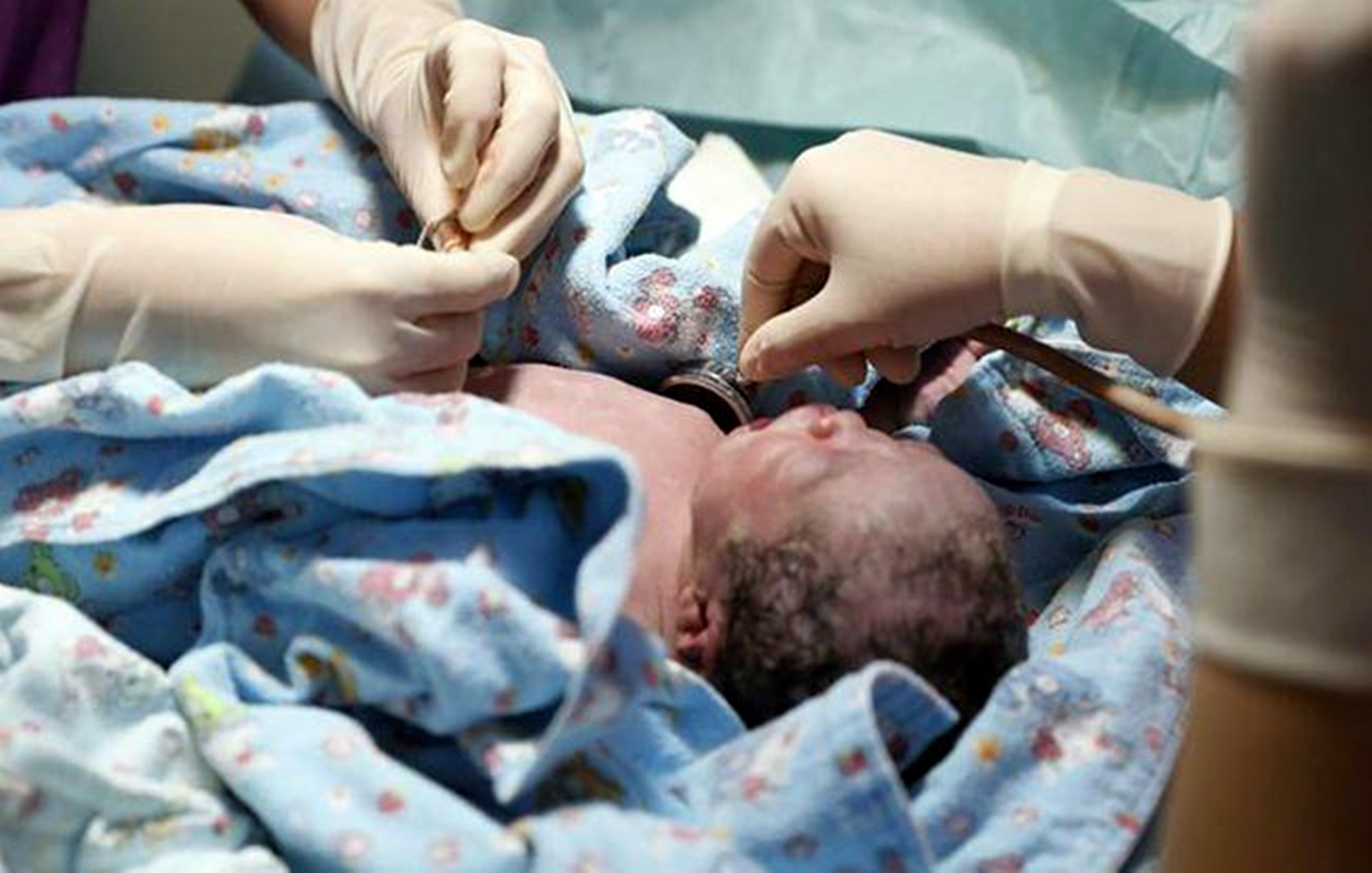 新生儿越长越瘦,掉头发,起疹子?7种发育异常别慌,是正常现象