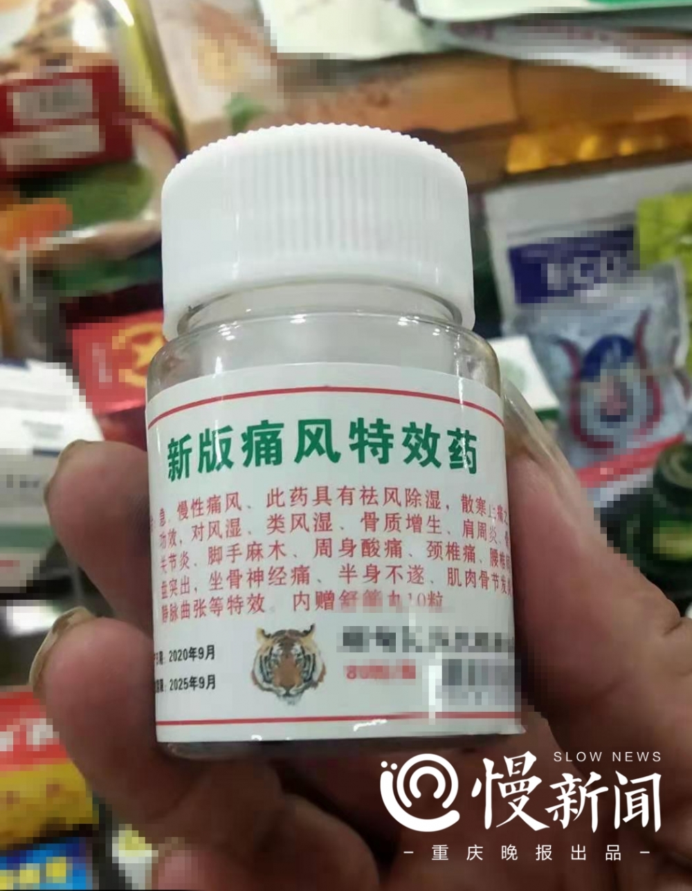 慢新闻健康30岁男子滥用国外痛风药体重暴涨80斤肚子上长紫纹