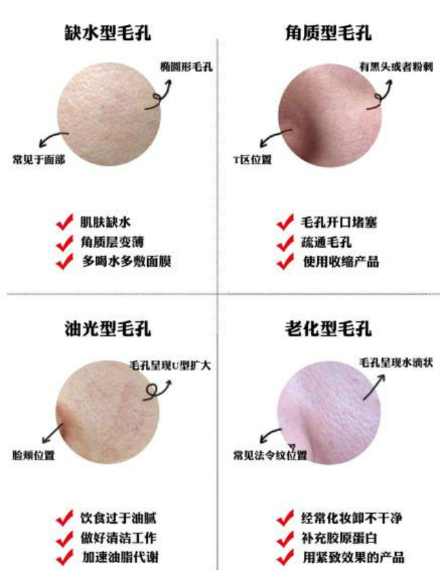 高圆圆新剧暴露皮肤问题毛孔粗大遮不住女神也难逃中年危机