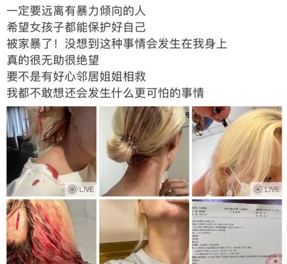 一女网红在直播间被丈夫殴打,被打到晕倒,被网友质疑炒作?休闲区蓝鸢梦想 - Www.slyday.coM