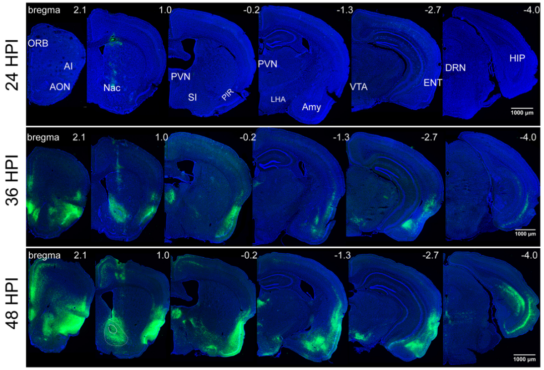 PS怎么做荧光边框 怎么用魔幻笔做荧光效果