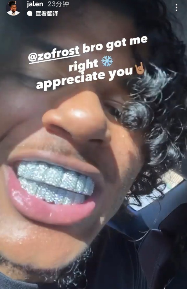 闪瞎了!火箭榜眼晒钻石牙套引热议 球迷调侃:第一笔工资花完了