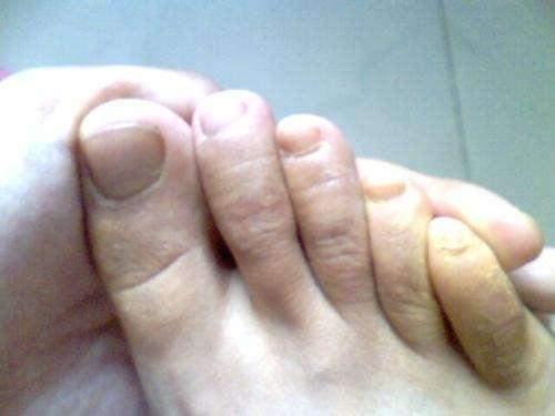 8岁女孩确诊糖尿病得知原因后妈妈再也不许去奶奶家