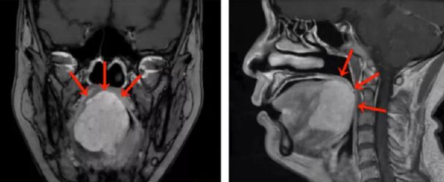 女子做核酸检测，竟意外发现自己患了癌休闲区蓝鸢梦想 - Www.slyday.coM